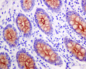 Immunohistochemistry (Formalin/PFA-fixed paraffin-embedded sections) - Anti-MUC4 antibody [EPR9308] (AB150381), expandable thumbnail