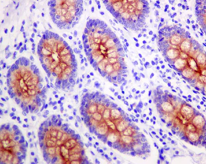 Immunohistochemistry (Formalin/PFA-fixed paraffin-embedded sections) - Anti-MUC4 antibody [EPR9308] (AB150381)
