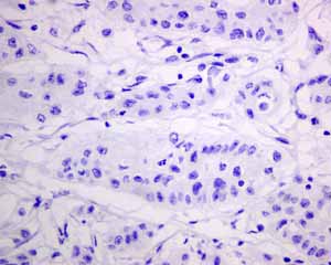 Immunohistochemistry (Formalin/PFA-fixed paraffin-embedded sections) - Anti-MUC4 antibody [EPR9308] (AB150381), expandable thumbnail