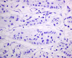 Immunohistochemistry (Formalin/PFA-fixed paraffin-embedded sections) - Anti-MUC4 antibody [EPR9308] (AB150381)