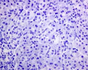 Immunohistochemistry (Formalin/PFA-fixed paraffin-embedded sections) - Anti-MUC4 antibody [EPR9308] (AB150381), expandable thumbnail