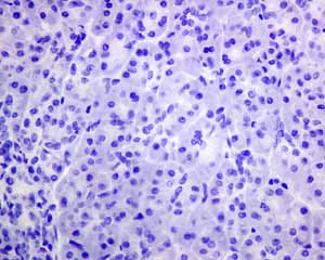 Immunohistochemistry (Formalin/PFA-fixed paraffin-embedded sections) - Anti-MUC4 antibody [EPR9308] (AB150381)