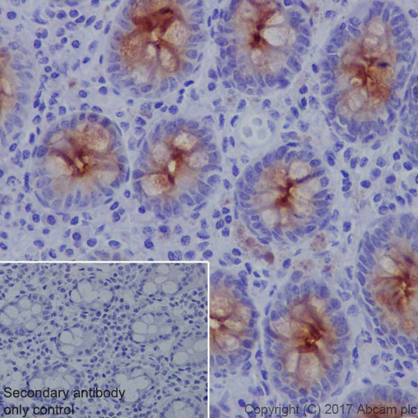 Immunohistochemistry (Formalin/PFA-fixed paraffin-embedded sections) - Anti-MUC4 antibody [EPR9308] (AB150381), expandable thumbnail