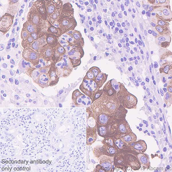 Immunohistochemistry (Formalin/PFA-fixed paraffin-embedded sections) - Anti-MUC4 antibody [SP241] - BSA and Azide free (AB243921)