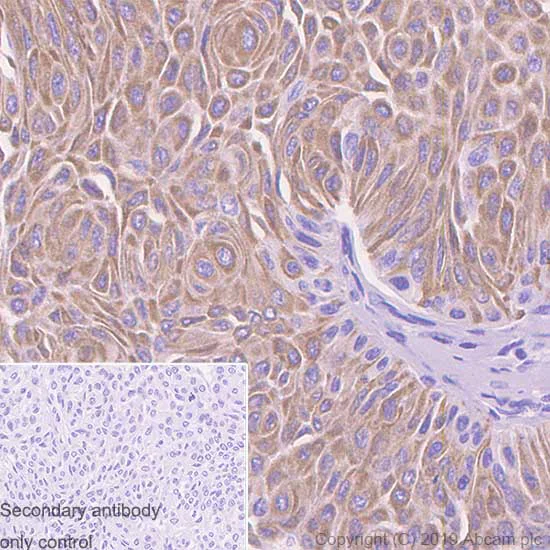 Immunohistochemistry (Formalin/PFA-fixed paraffin-embedded sections) - Anti-MUC4 antibody [SP241] - BSA and Azide free (AB243921)