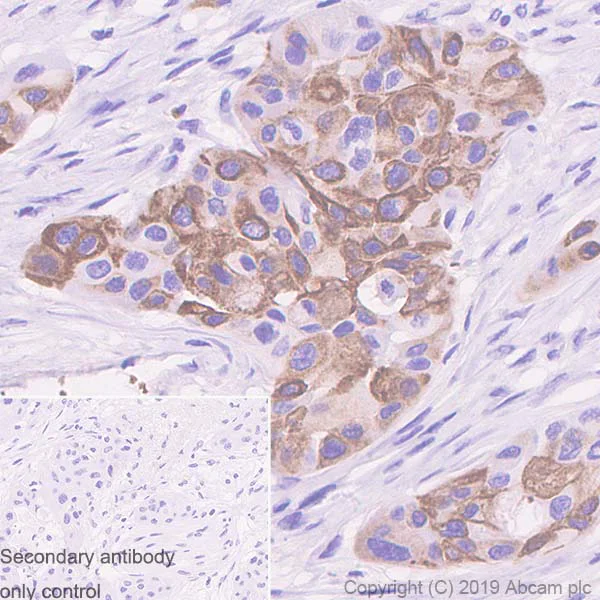 Immunohistochemistry (Formalin/PFA-fixed paraffin-embedded sections) - Anti-MUC4 antibody [SP241] - C-terminal (AB183320)
