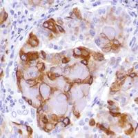 Immunohistochemistry (Formalin/PFA-fixed paraffin-embedded sections) - Anti-MUC4 antibody [SP241] - C-terminal (AB183320)