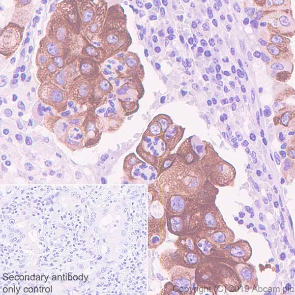 Immunohistochemistry (Formalin/PFA-fixed paraffin-embedded sections) - Anti-MUC4 antibody [SP241] - C-terminal (AB183320)