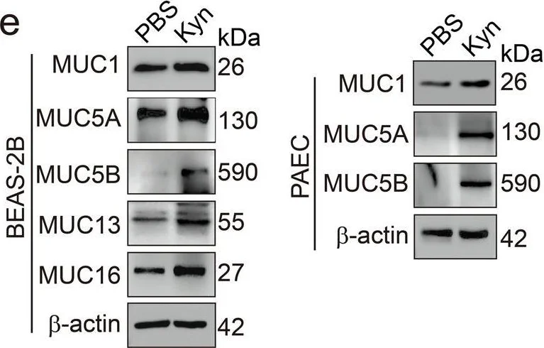 Western blot - Anti-MUC5B antibody [19.4E] (AB77995)