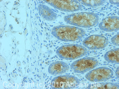 Immunohistochemistry (Formalin/PFA-fixed paraffin-embedded sections) - Anti-MUC5B antibody (AB87376), expandable thumbnail