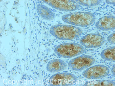 Immunohistochemistry (Formalin/PFA-fixed paraffin-embedded sections) - Anti-MUC5B antibody (AB87376)