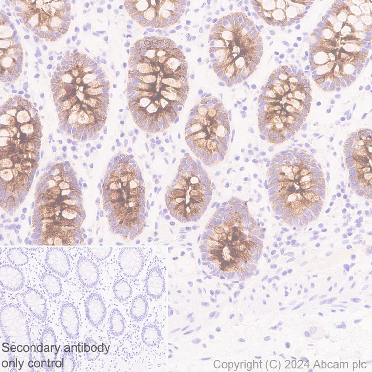 Immunohistochemistry (Formalin/PFA-fixed paraffin-embedded sections) - Anti-MUC5B antibody [EPR27200-159] (AB315330)