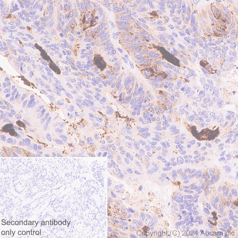 Immunohistochemistry (Formalin/PFA-fixed paraffin-embedded sections) - Anti-MUC5B antibody [EPR27200-159] (AB315330)