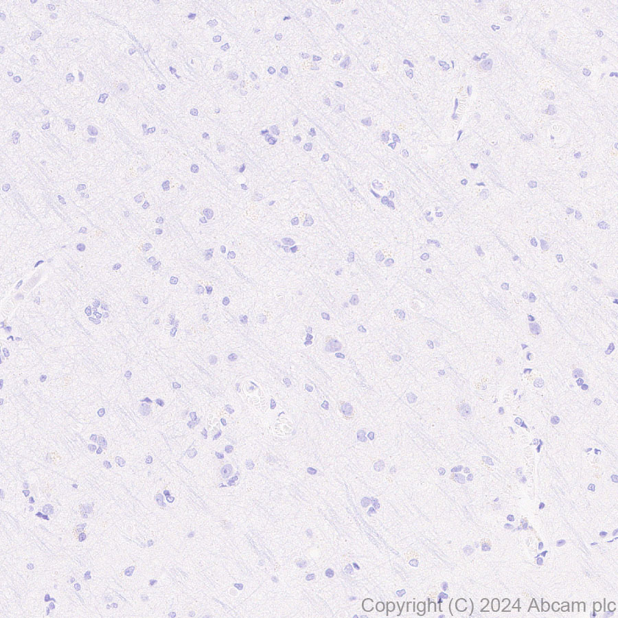 Immunohistochemistry (Formalin/PFA-fixed paraffin-embedded sections) - Anti-MUC5B antibody [EPR27200-159] (AB315330)