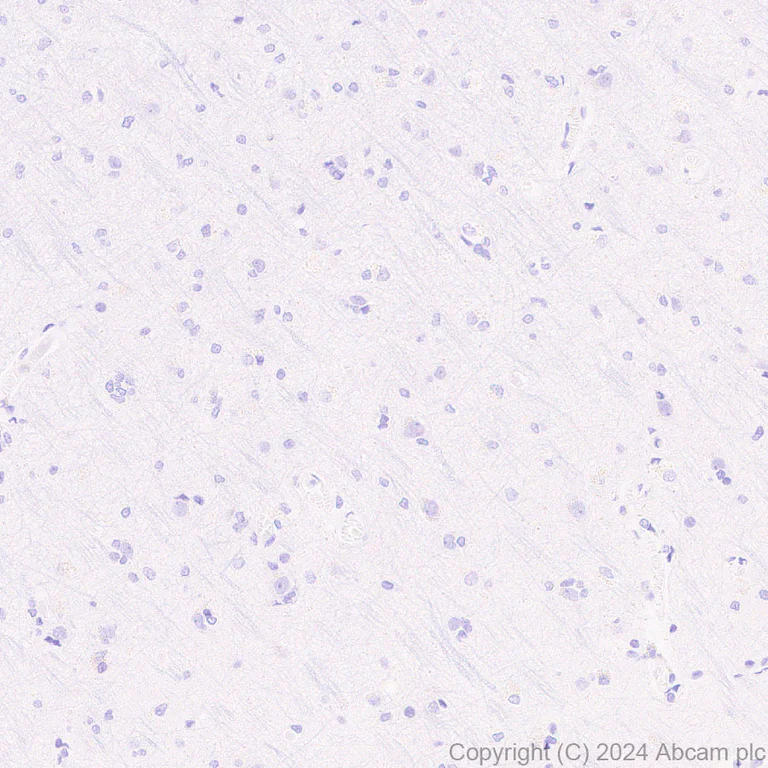 Immunohistochemistry (Formalin/PFA-fixed paraffin-embedded sections) - Anti-MUC5B antibody [EPR27200-159] (AB315330)