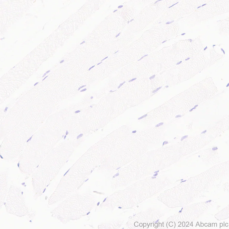 Immunohistochemistry (Formalin/PFA-fixed paraffin-embedded sections) - Anti-MUC5B antibody [EPR27200-159] - BSA and Azide free (AB315331)