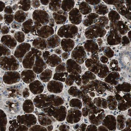 Immunohistochemistry (Formalin/PFA-fixed paraffin-embedded sections) - Anti-MUC7/MG2 antibody (AB224342)