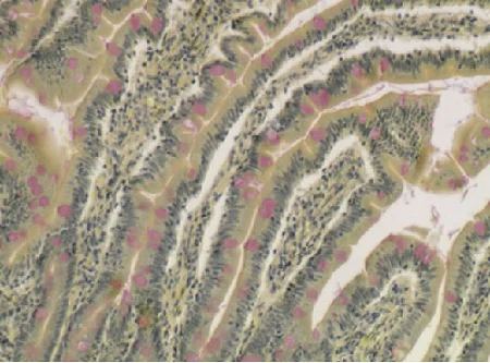 Immunohistochemistry (Formalin/PFA-fixed paraffin-embedded sections) - Mucicarmine Stain Kit (Mucin Stain) (AB150677)
