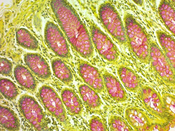 Immunohistochemistry (Formalin/PFA-fixed paraffin-embedded sections) - Mucicarmine Stain Kit (Mucin Stain) (AB150677)