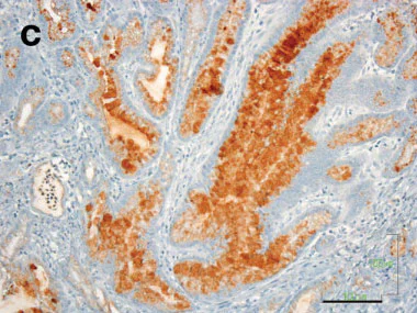 Immunohistochemistry (Formalin/PFA-fixed paraffin-embedded sections) - Anti-Mucin 5AC antibody [45M1] (AB3649)