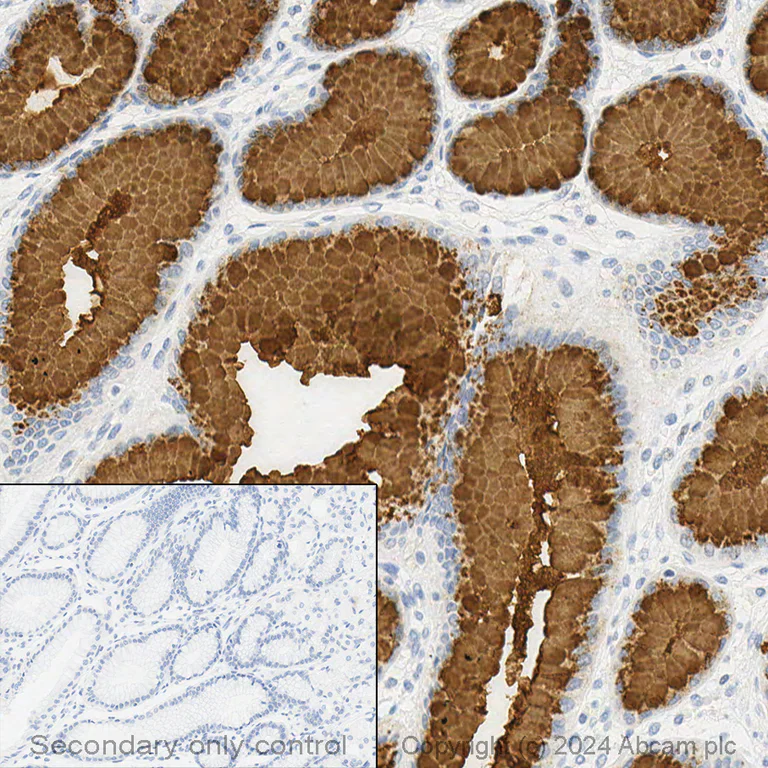 Immunohistochemistry (Formalin/PFA-fixed paraffin-embedded sections) - Anti-Mucin 5AC antibody [45M1] - BSA and Azide free (AB212636)