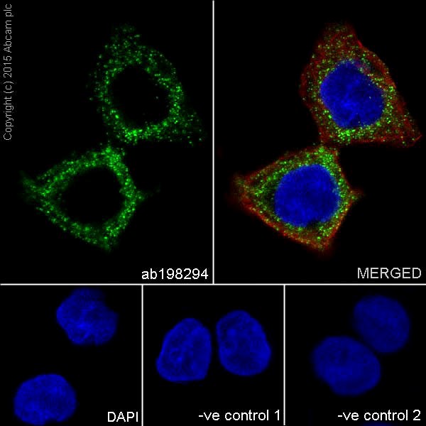 Immunocytochemistry/ Immunofluorescence - Anti-Mucin 5AC antibody [EPR16904] (AB198294), expandable thumbnail