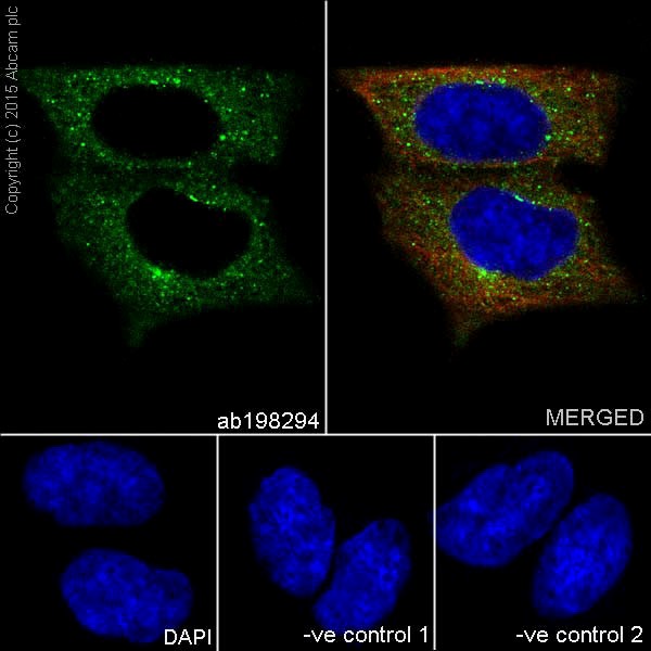Immunocytochemistry/ Immunofluorescence - Anti-Mucin 5AC antibody [EPR16904] (AB198294), expandable thumbnail
