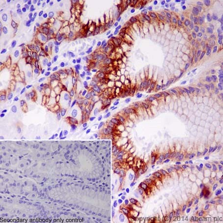 Immunohistochemistry (Formalin/PFA-fixed paraffin-embedded sections) - Anti-Mucin 5AC antibody [EPR16904] (AB198294), expandable thumbnail