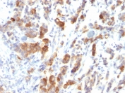 Immunohistochemistry (Formalin/PFA-fixed paraffin-embedded sections) - Anti-Mucin 5AC antibody [MUC5AC/917] - BSA and Azide free (AB216007), expandable thumbnail