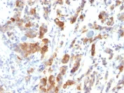 Immunohistochemistry (Formalin/PFA-fixed paraffin-embedded sections) - Anti-Mucin 5AC antibody [MUC5AC/917] - BSA and Azide free (AB216007)