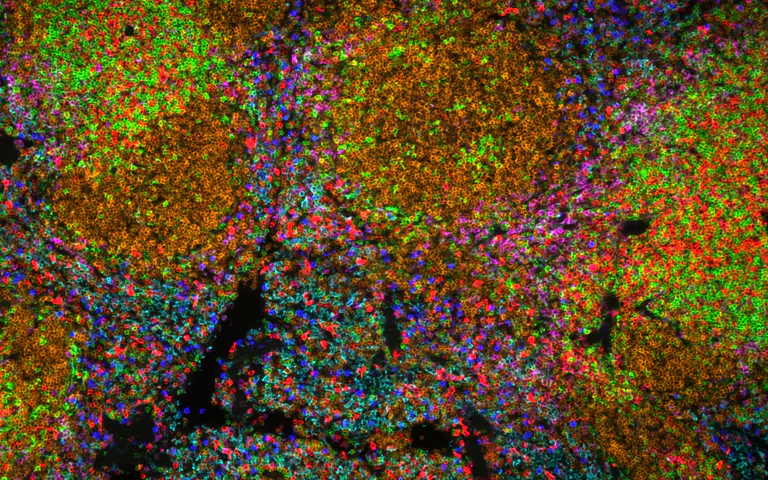 Immunohistochemistry (Frozen sections) - Multiplex IHC Detection kit (TSA amplification) (AB312827)