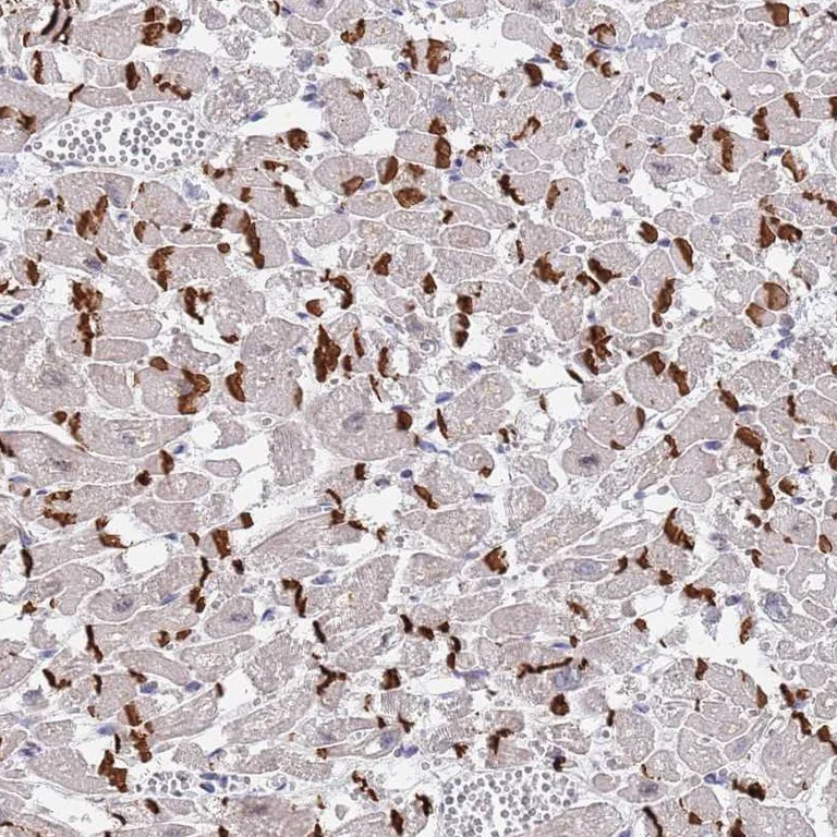 Immunohistochemistry (Formalin/PFA-fixed paraffin-embedded sections) - Anti-MUM1 antibody (AB247079)