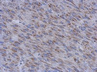 Immunohistochemistry (Formalin/PFA-fixed paraffin-embedded sections) - Anti-MUM1L1 antibody (AB111834), expandable thumbnail