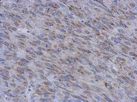 Immunohistochemistry (Formalin/PFA-fixed paraffin-embedded sections) - Anti-MUM1L1 antibody (AB111834)