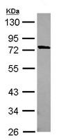 Western blot - Anti-MUM1L1 antibody (AB111834), expandable thumbnail