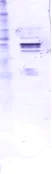 Western blot - Anti-Mumps nucleoprotein antibody [7B10] (AB9880)