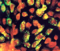 Immunocytochemistry/ Immunofluorescence - Anti-Mumps nucleoprotein antibody [8H4] (AB9876)