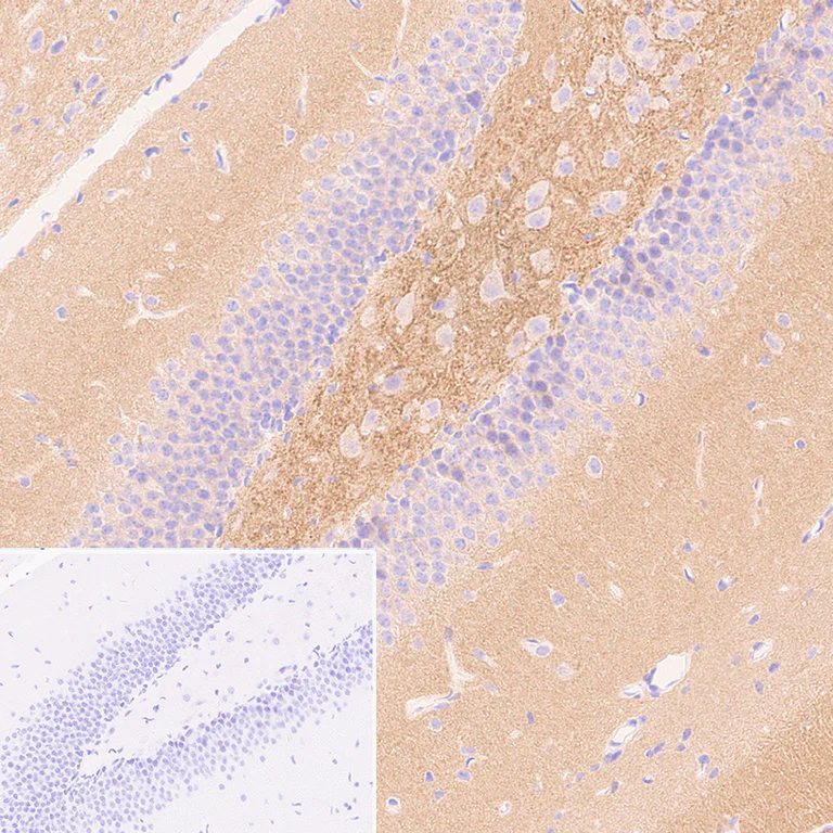 Immunohistochemistry (Formalin/PFA-fixed paraffin-embedded sections) - Anti-Munc13-1 antibody [EPR27022-47] - BSA and Azide free (AB307512)