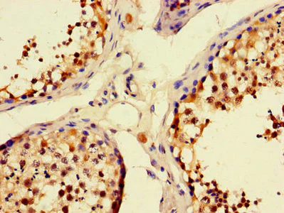 Immunohistochemistry (Formalin/PFA-fixed paraffin-embedded sections) - Anti-Munc13-3 antibody (AB234798)