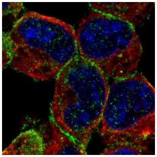 Immunocytochemistry/ Immunofluorescence - Anti-Munc18-1 antibody (AB155020)