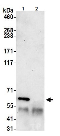 Immunoprecipitation - Anti-Munc18-1 antibody (AB264385)