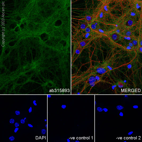 Immunocytochemistry/ Immunofluorescence - Anti-Munc18-1 antibody [EPR27956-86] (AB315893)