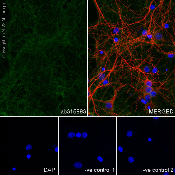Immunocytochemistry/ Immunofluorescence - Anti-Munc18-1 antibody [EPR27956-86] (AB315893)