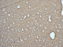Immunohistochemistry (Formalin/PFA-fixed paraffin-embedded sections) - Anti-Munc18-1 antibody [EPR4850] (AB124920), expandable thumbnail