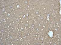 Immunohistochemistry (Formalin/PFA-fixed paraffin-embedded sections) - Anti-Munc18-1 antibody [EPR4850] (AB124920)