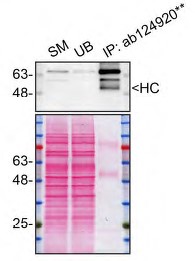 Immunoprecipitation - Anti-Munc18-1 antibody [EPR4850] (AB124920), expandable thumbnail