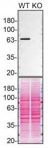 Western blot - Anti-Munc18-1 antibody [EPR4850] (AB124920), expandable thumbnail