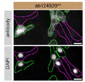Immunocytochemistry/ Immunofluorescence - Anti-Munc18-1 antibody [EPR4850] - BSA and Azide free (AB248059)