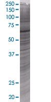 SDS-PAGE - Munc18-1 overexpression 293T lysate (whole cell) (AB94272)