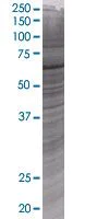 SDS-PAGE - Munc18-1 overexpression 293T lysate (whole cell) (AB94272)